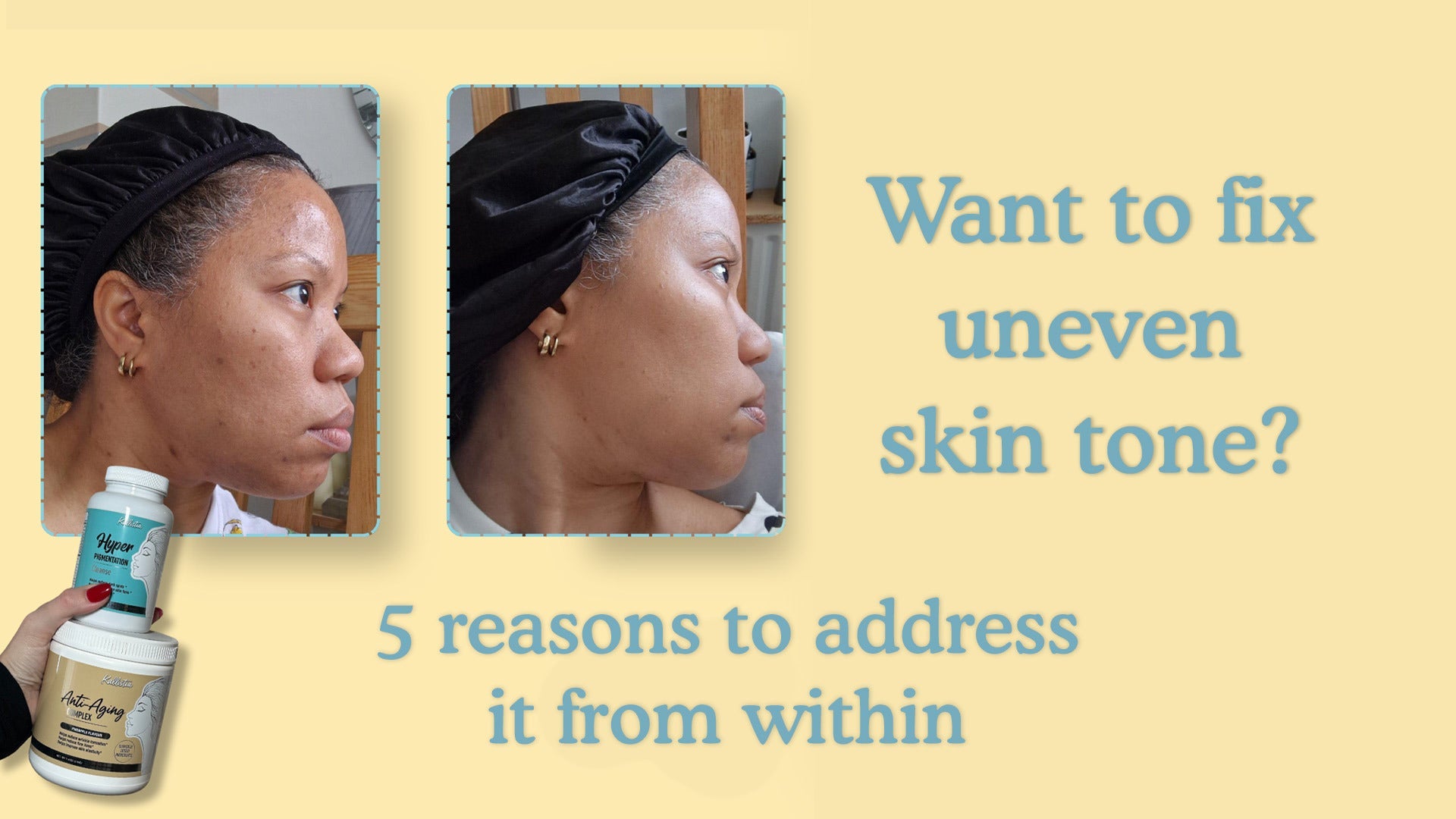 5 reasons to target uneven skin tone from within