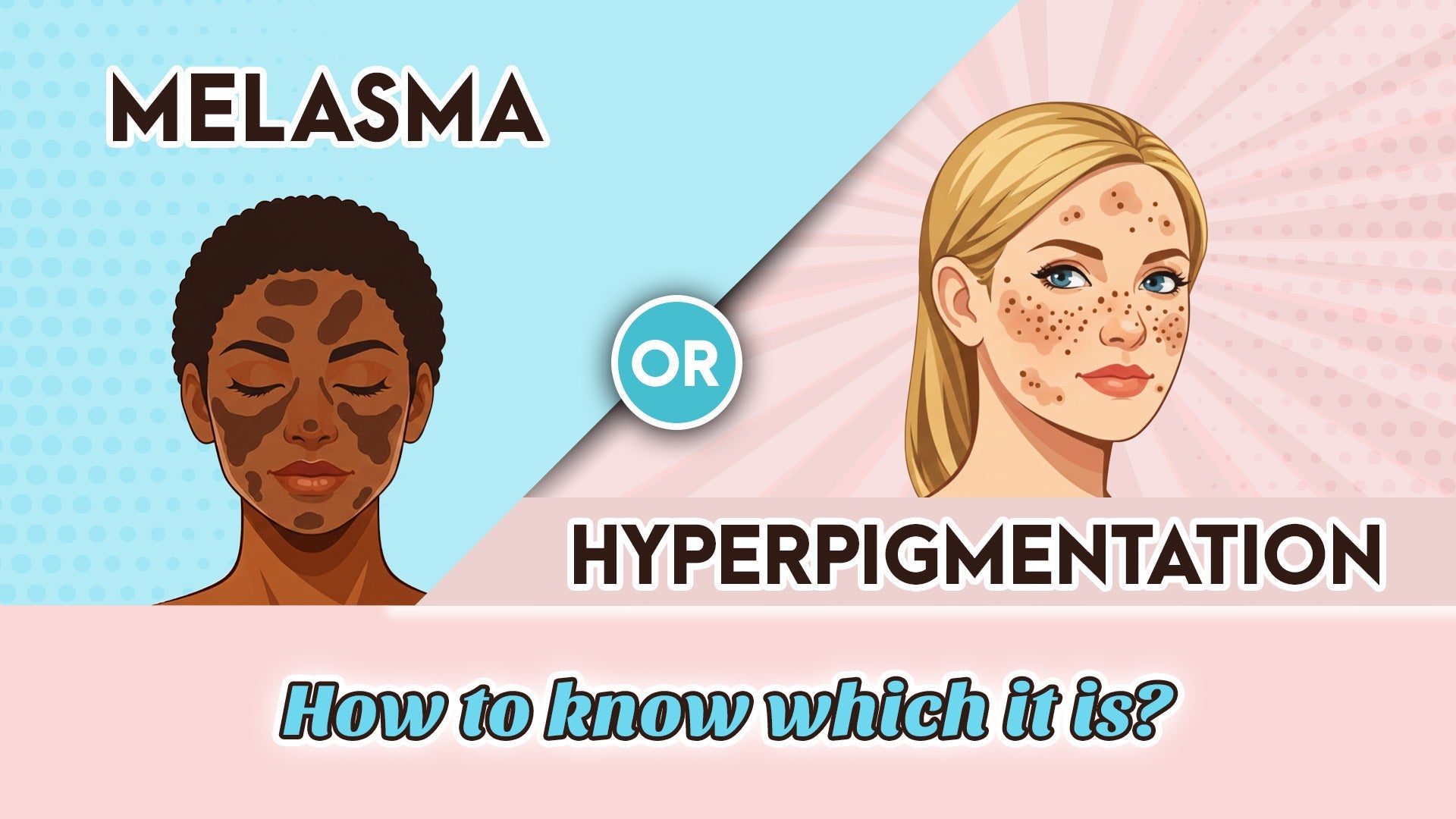 Melasma or hyperpigmentation?