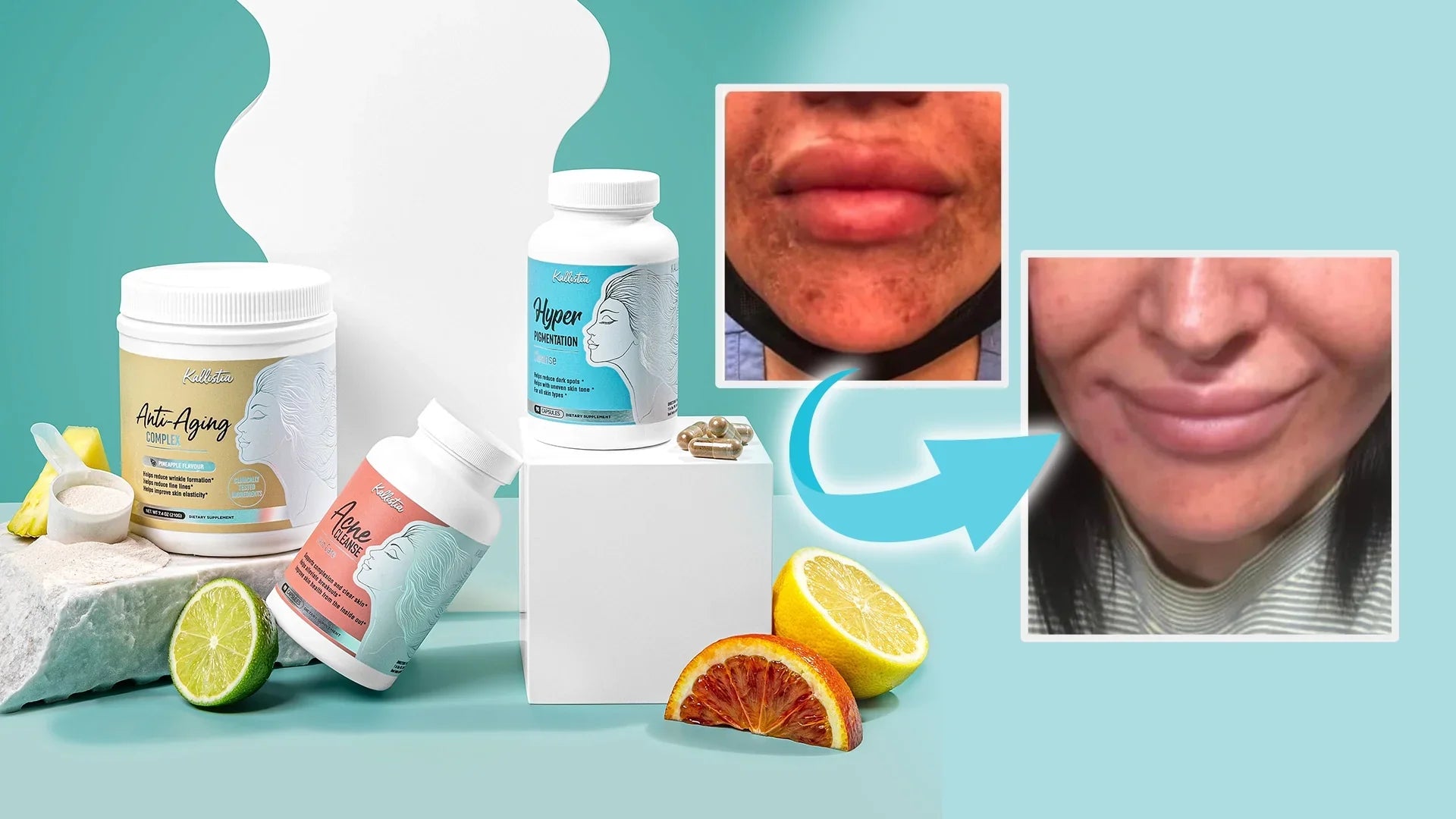 Dark Upper Lip That Just Won't Fade?
