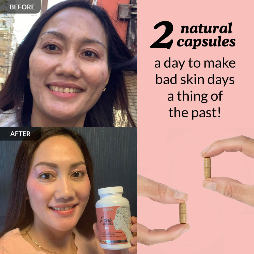 Before and after comparison of a woman's face with text about natural capsules for skin health on a pink background.
