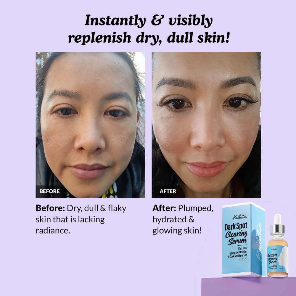 Before and after comparison of skin with a product packaging on a purple background