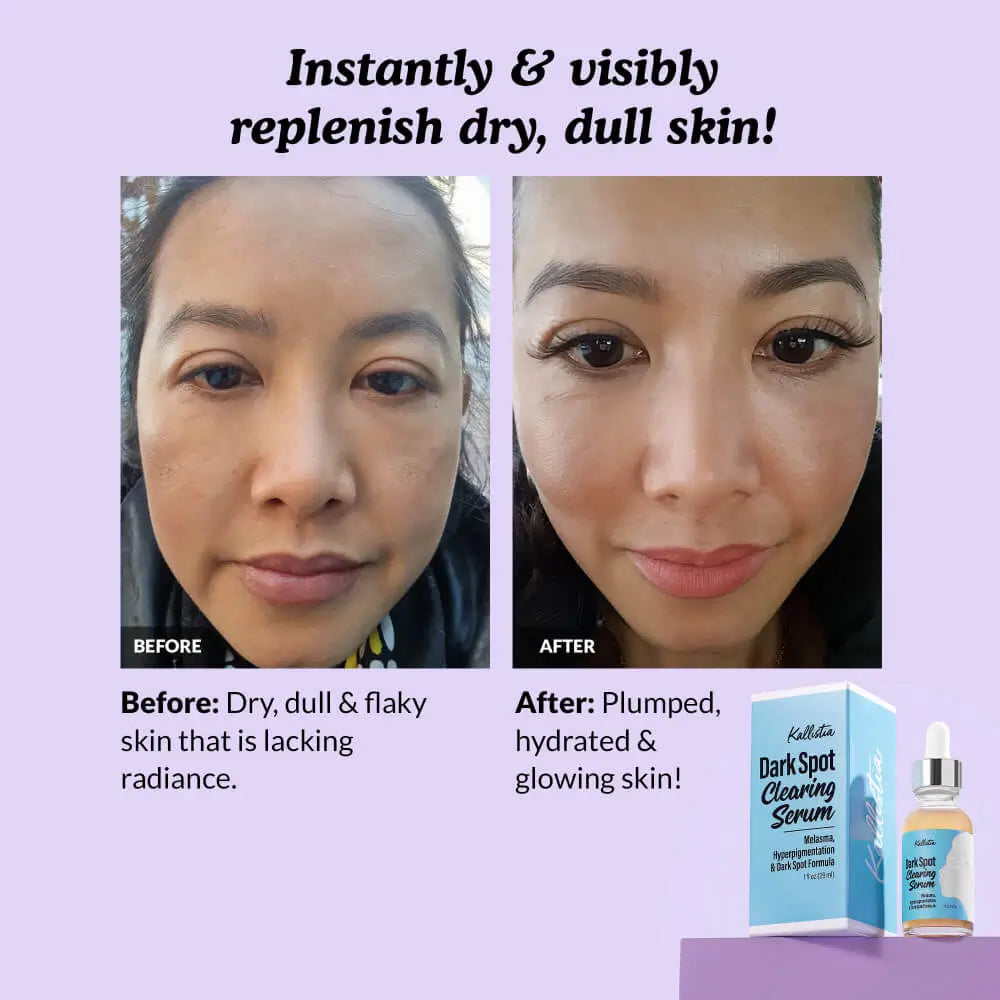 Dark Spot Clearing Serum