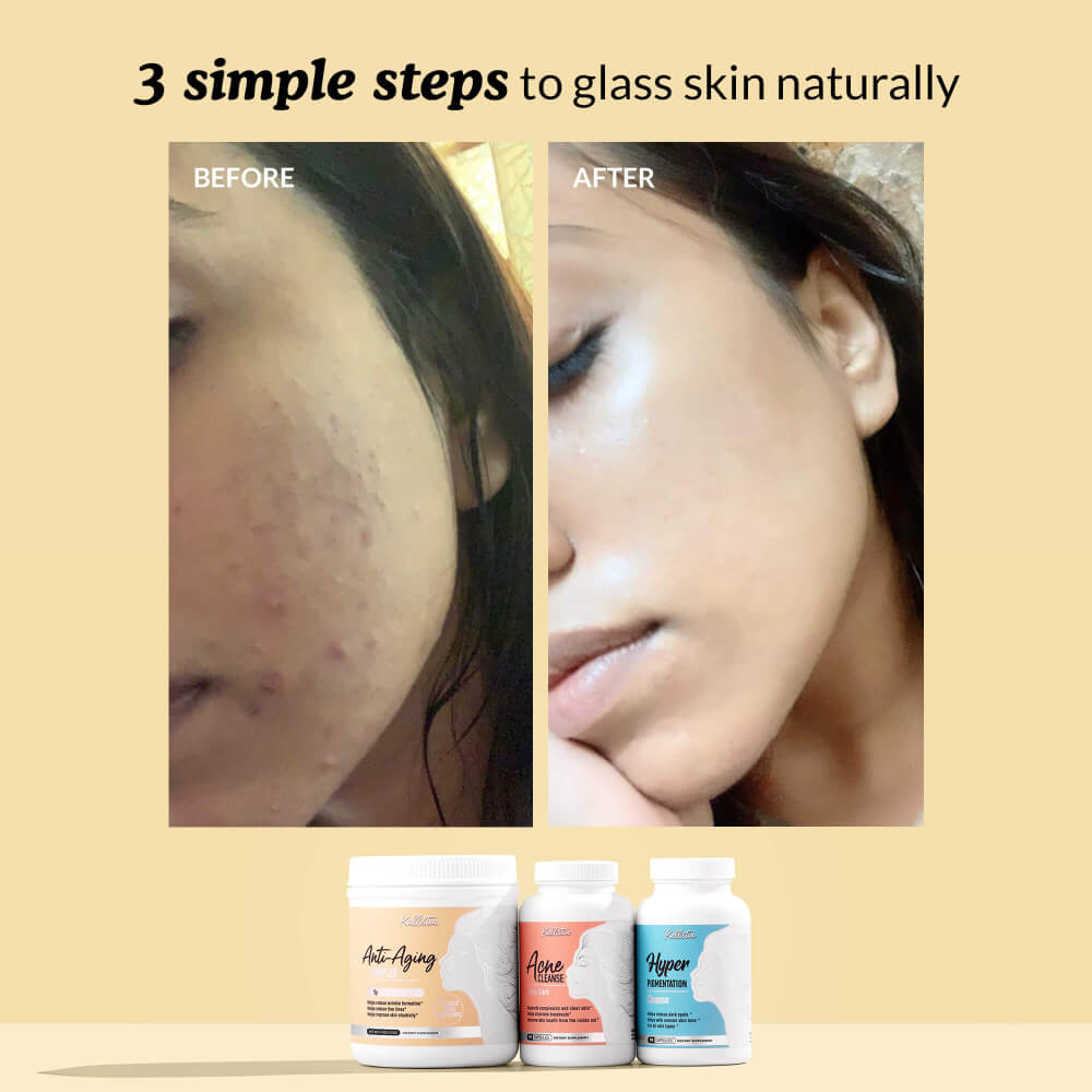 Before and after comparison of skin with skincare products displayed below.