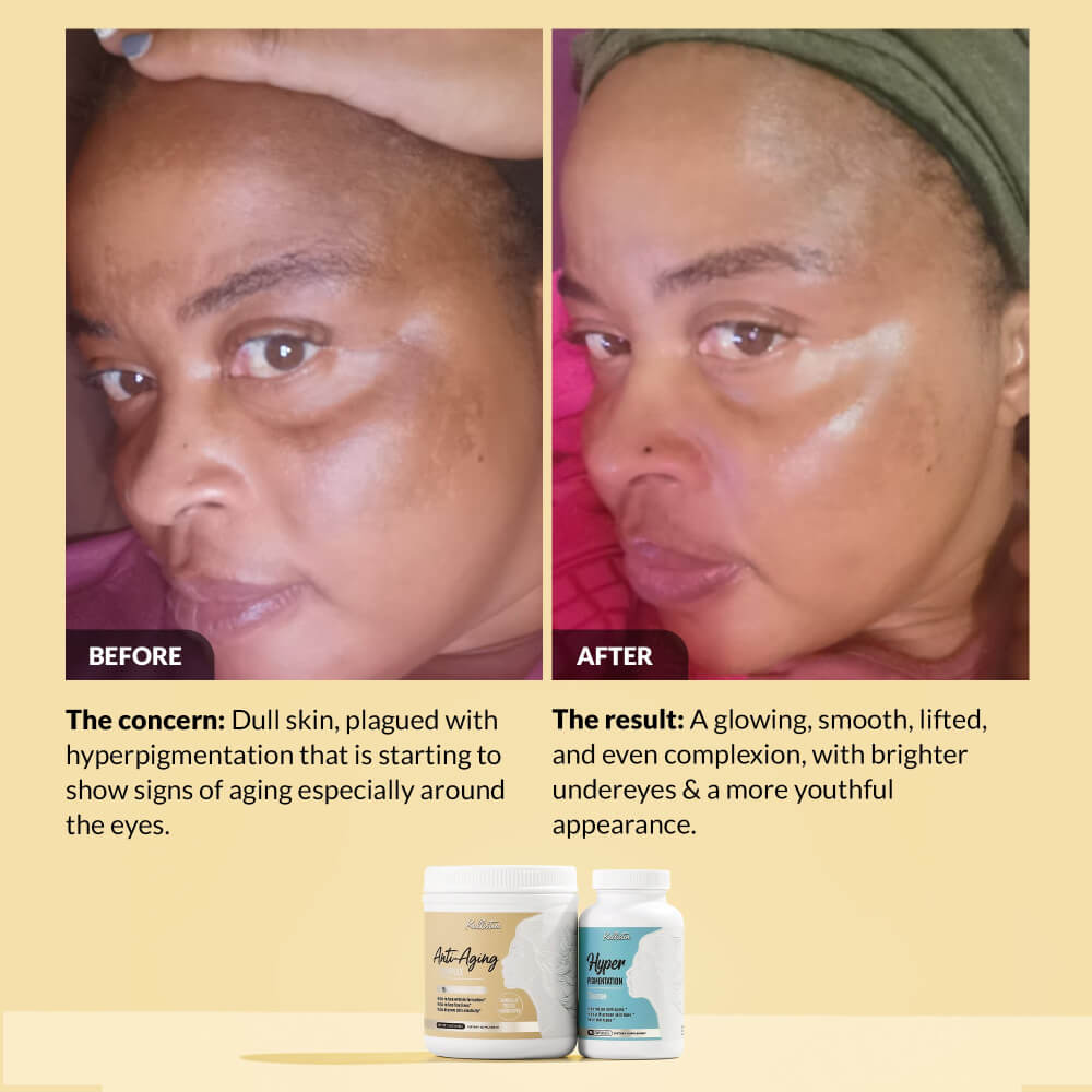 Before and after comparison of skin treatment with product packaging displayed.