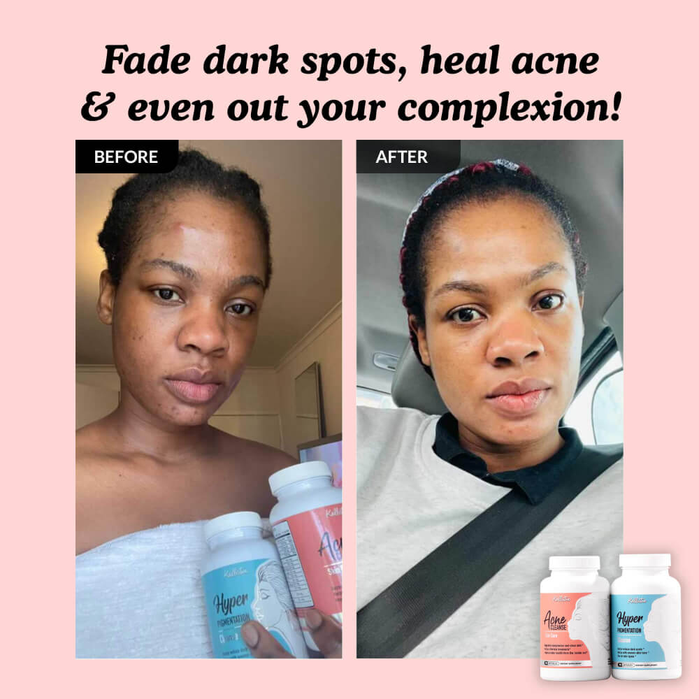 ANGEBOT „Clear Complexion Kit + Gratis-Serum“