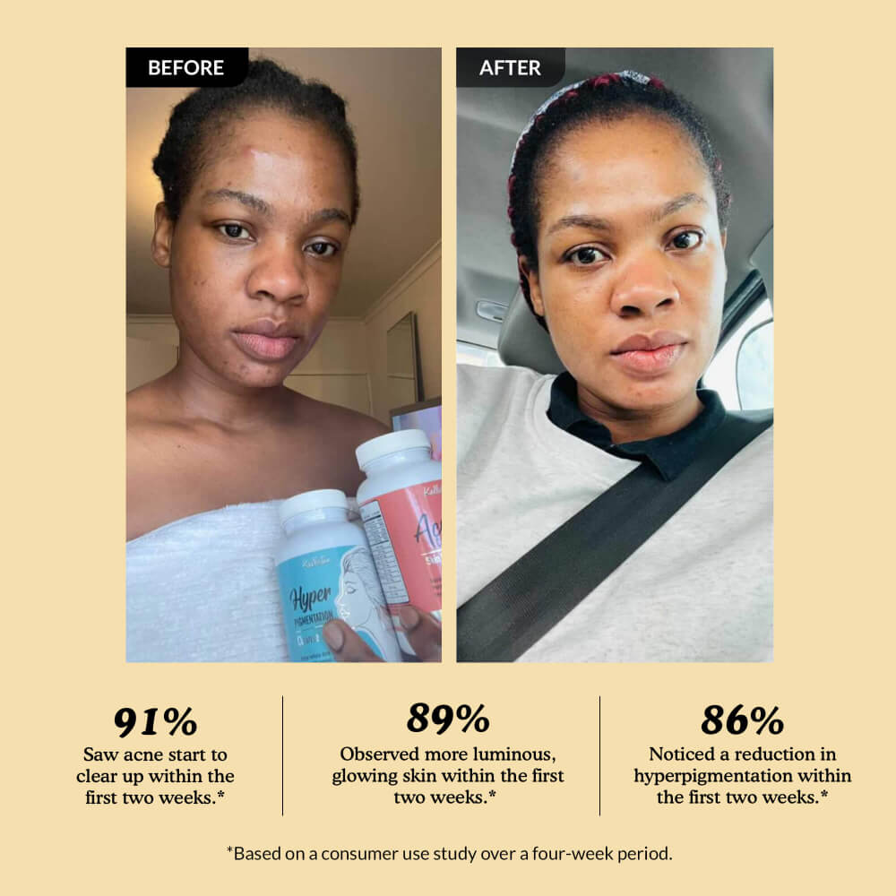 Before and after comparison of a person using skincare products, with text indicating improvement percentages.