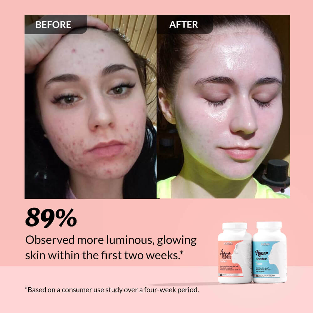 ANGEBOT „Clear Complexion Kit + Gratis-Serum“