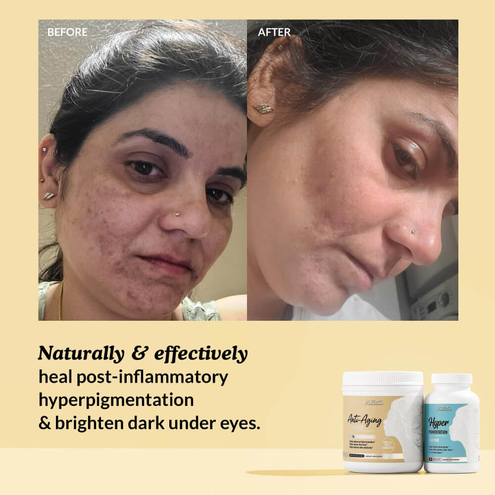 Before and after comparison of a person's face with text and product images on a beige background.