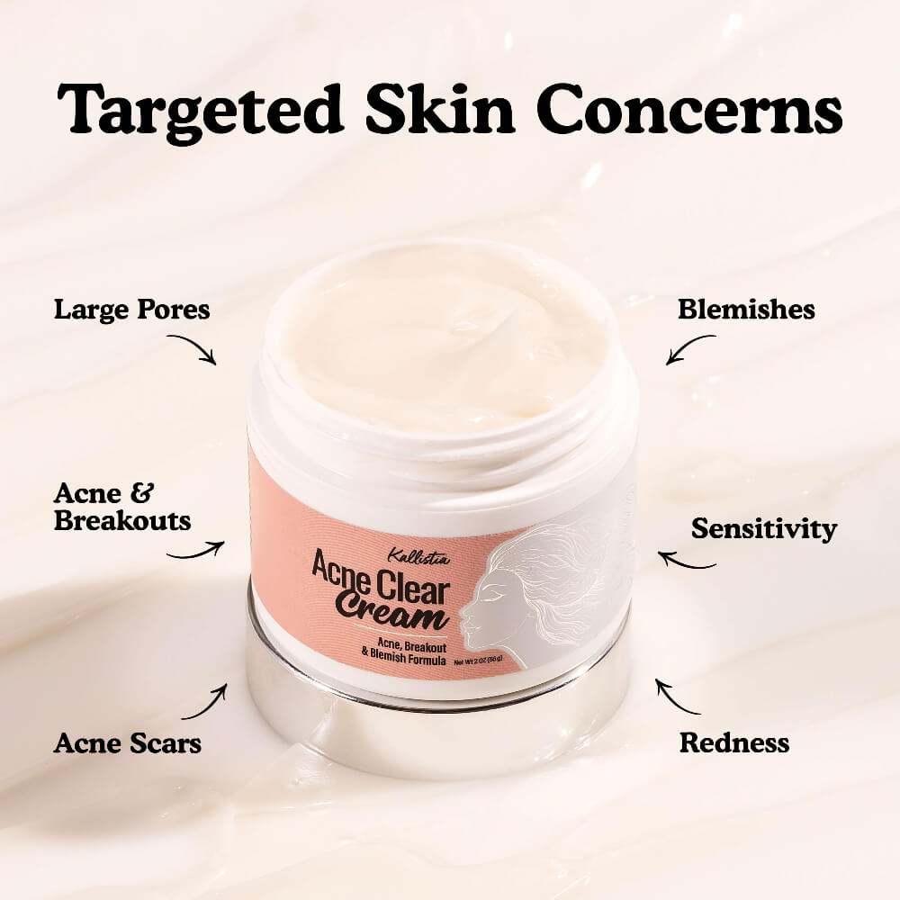 Jar of Acne Clear Cream with labeled skin concerns on a white background