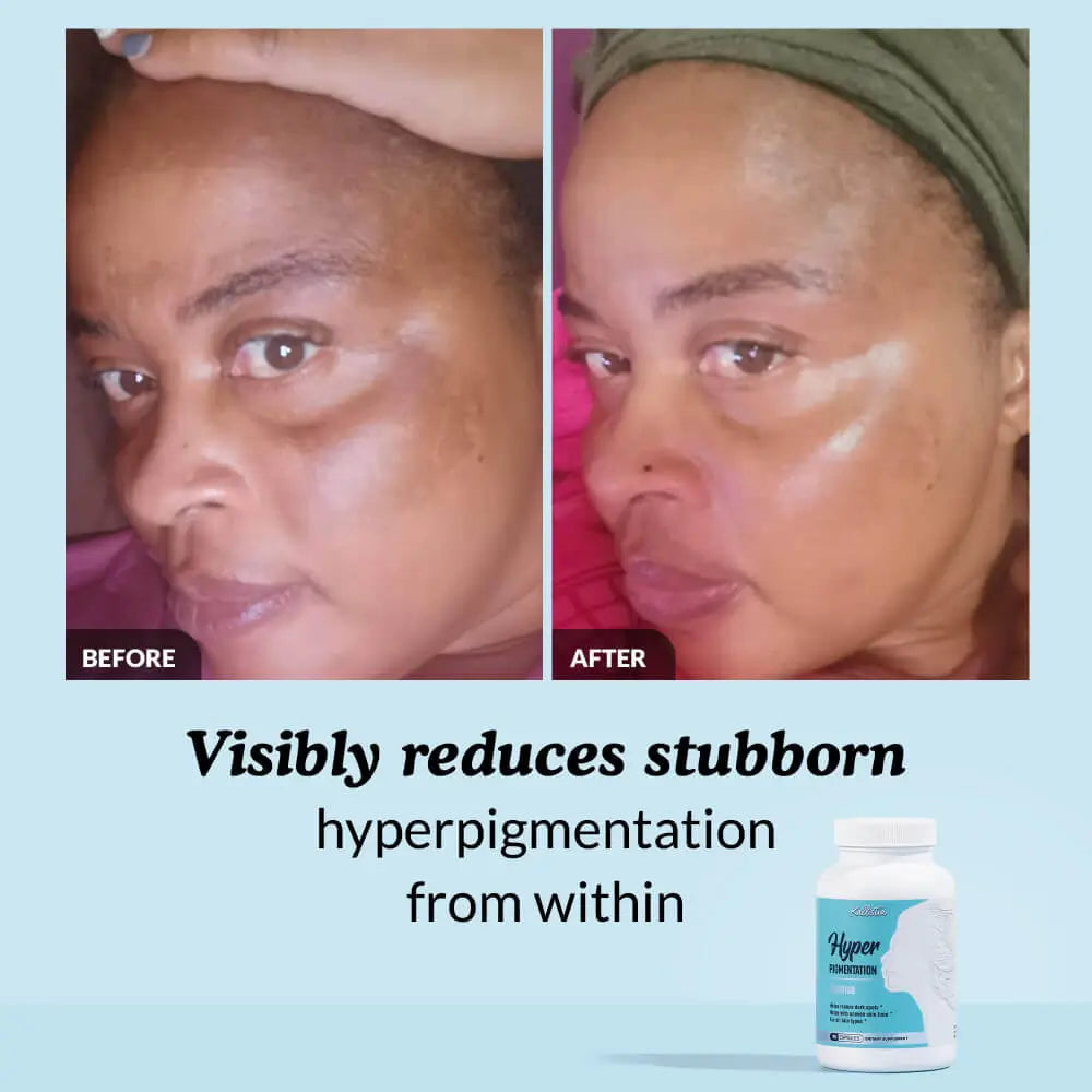 Hyperpigmentation Cleanse Capsules Kit