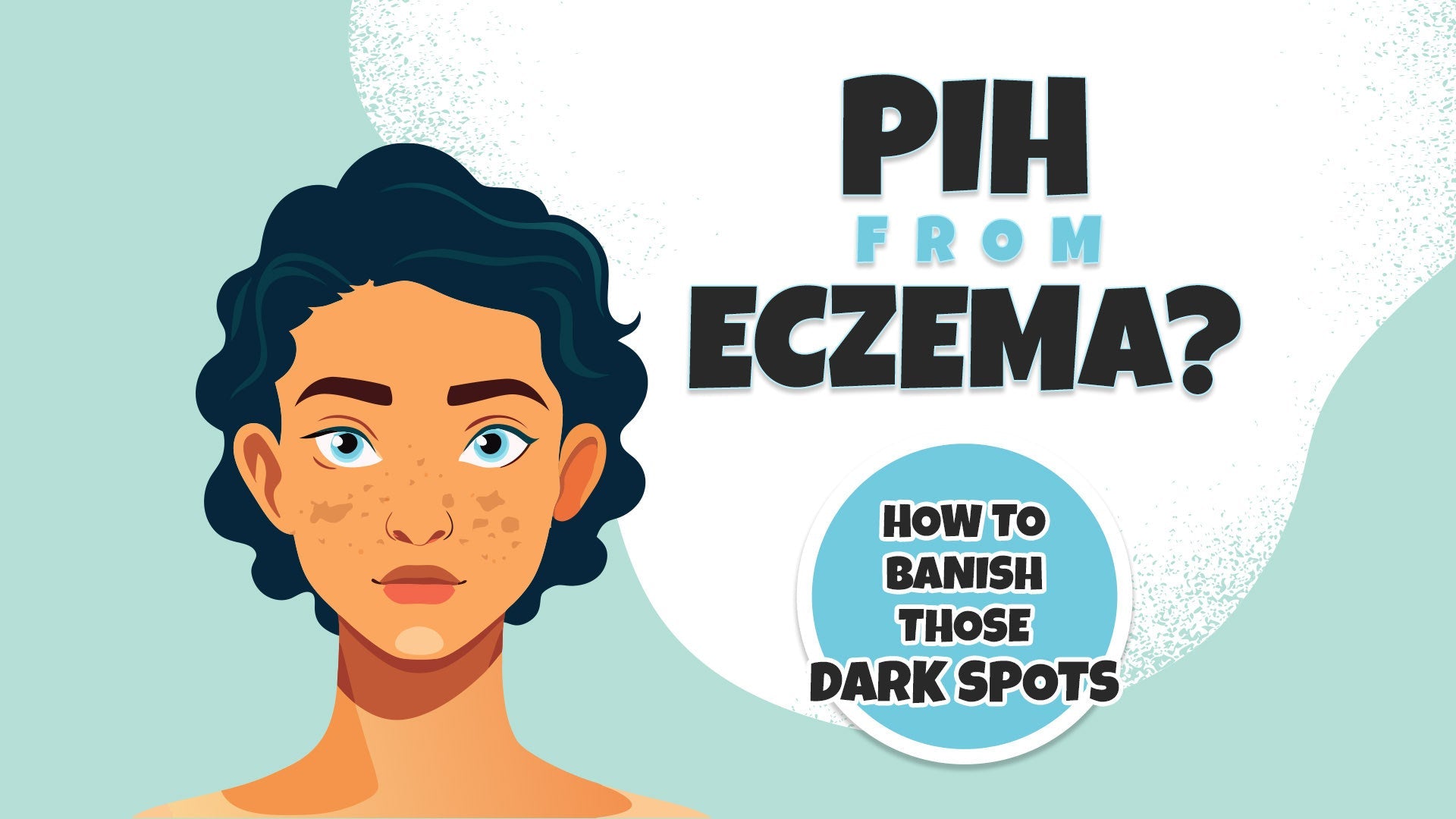 PIH from Eczema?
