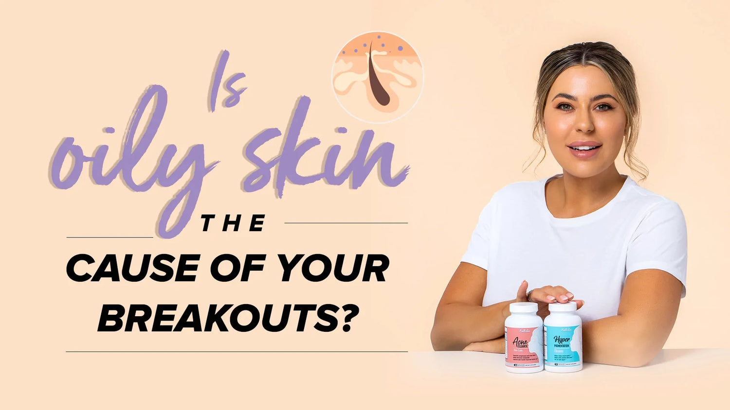 Is oily skin the cause of your breakouts?