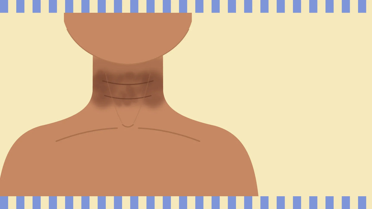 Dark neck? - Why you should stop rubbing creams on it