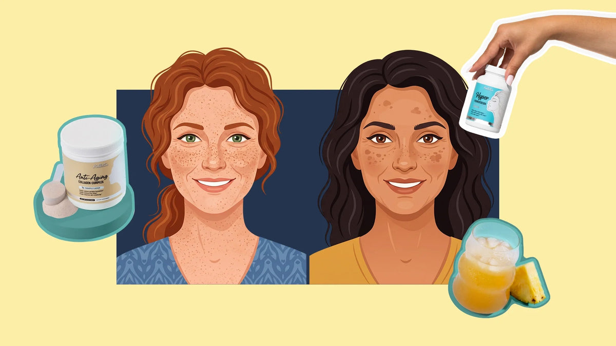 Freckles vs Hyperpigmentation - Which ones can actually fade?