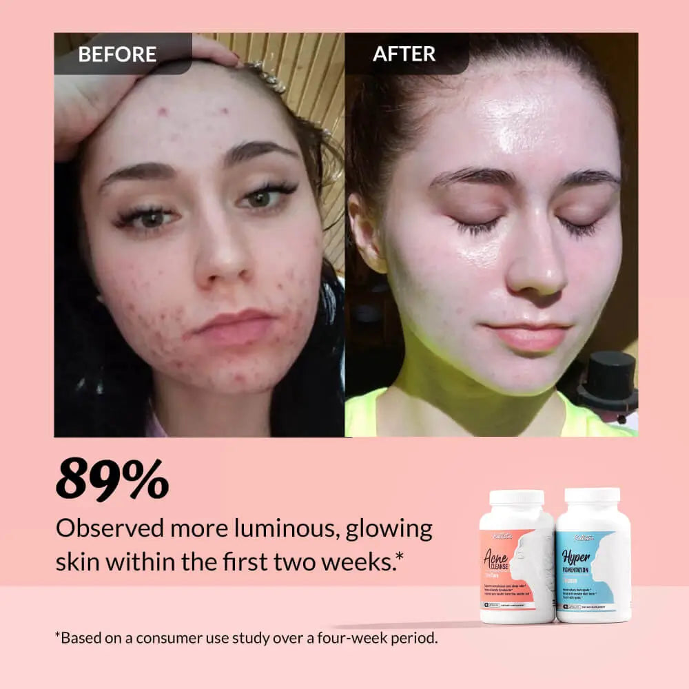 Kit Clear Complexion + OFERTA de Sérum Grátis