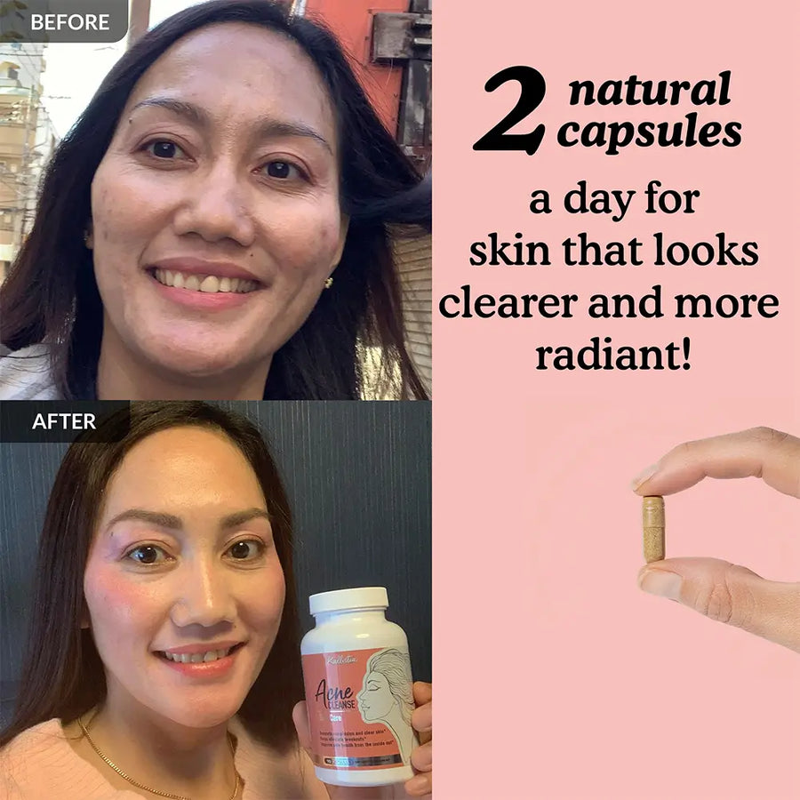 Acne Cleanse Capsules Kit