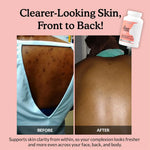 Acne Cleanse Capsules Kit