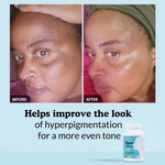 Hyperpigmentation Cleanse Capsules
