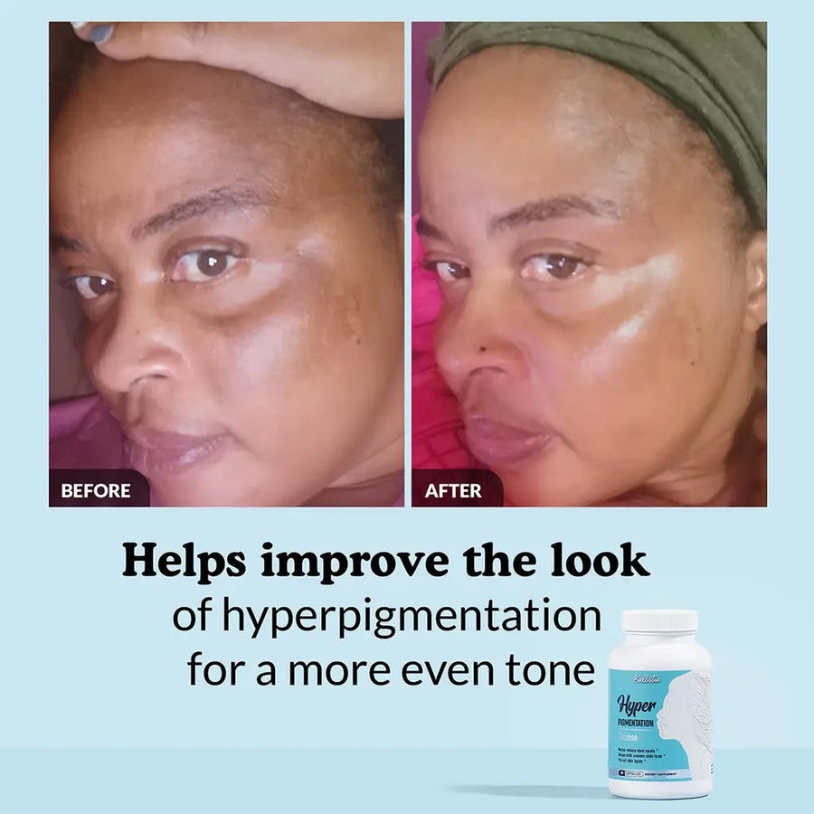 Hyperpigmentation Cleanse Capsules