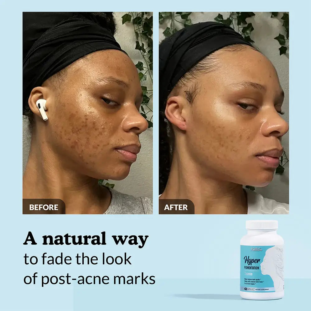 Hyperpigmentation Cleanse Capsules Kit