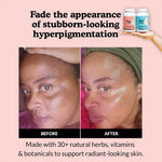 Before and after comparison of skin hyperpigmentation treatment with Acne Cleanse and Hyperpigmentation Cleanse on a pink background.