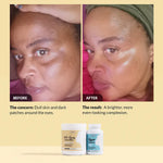 Hyper Renew Kit before and after: dull skin and dark patches around the eyes fade to a brighter, more even-looking complexion