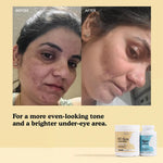 Hyper Renew Kit before and after: for a more even-looking tone and a brighter under-eye area