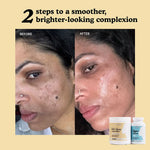 Hyper Renew Kit: two steps to a smoother, brighter-looking complexion, before and after results
