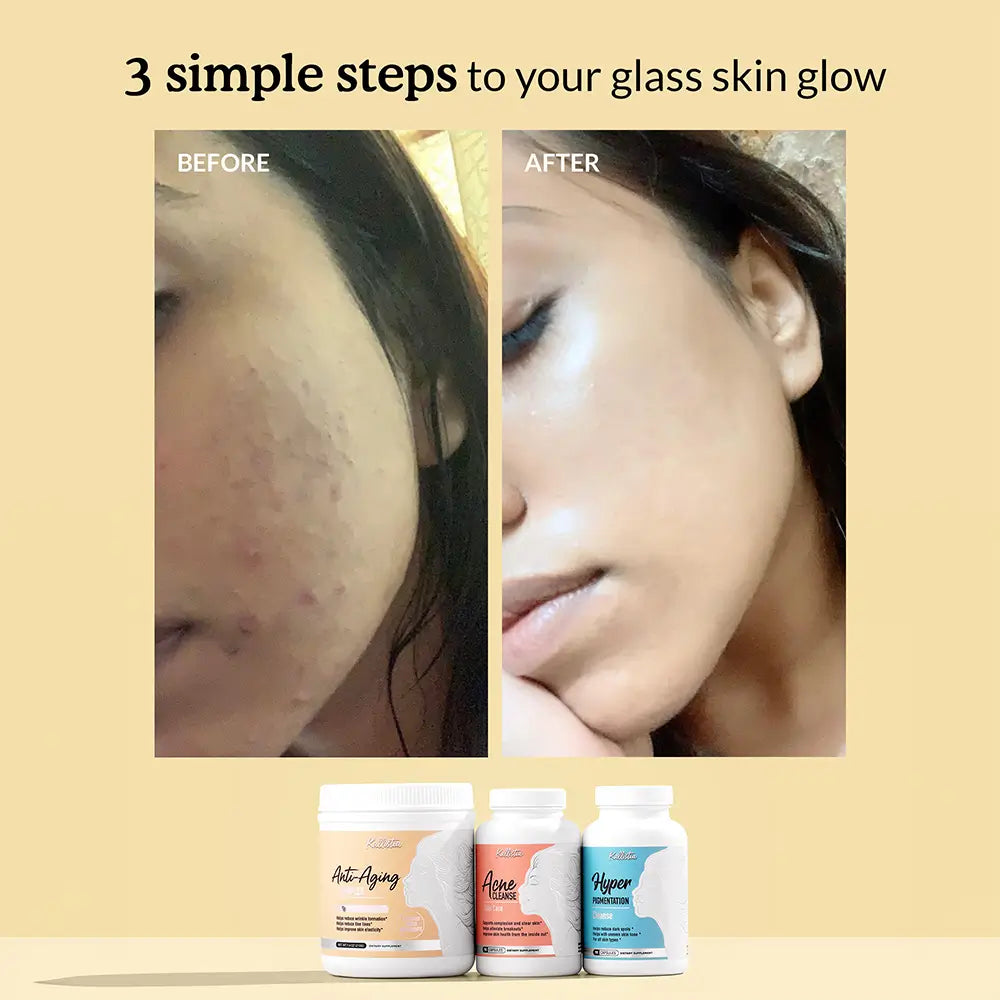 Perfect Skin Kit