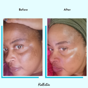 kallistia Hyperpigmentation Cleanse Capsules